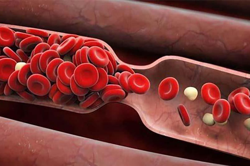Lưu thông khí huyết là gì? Cách giúp máu lưu thông hiệu quả